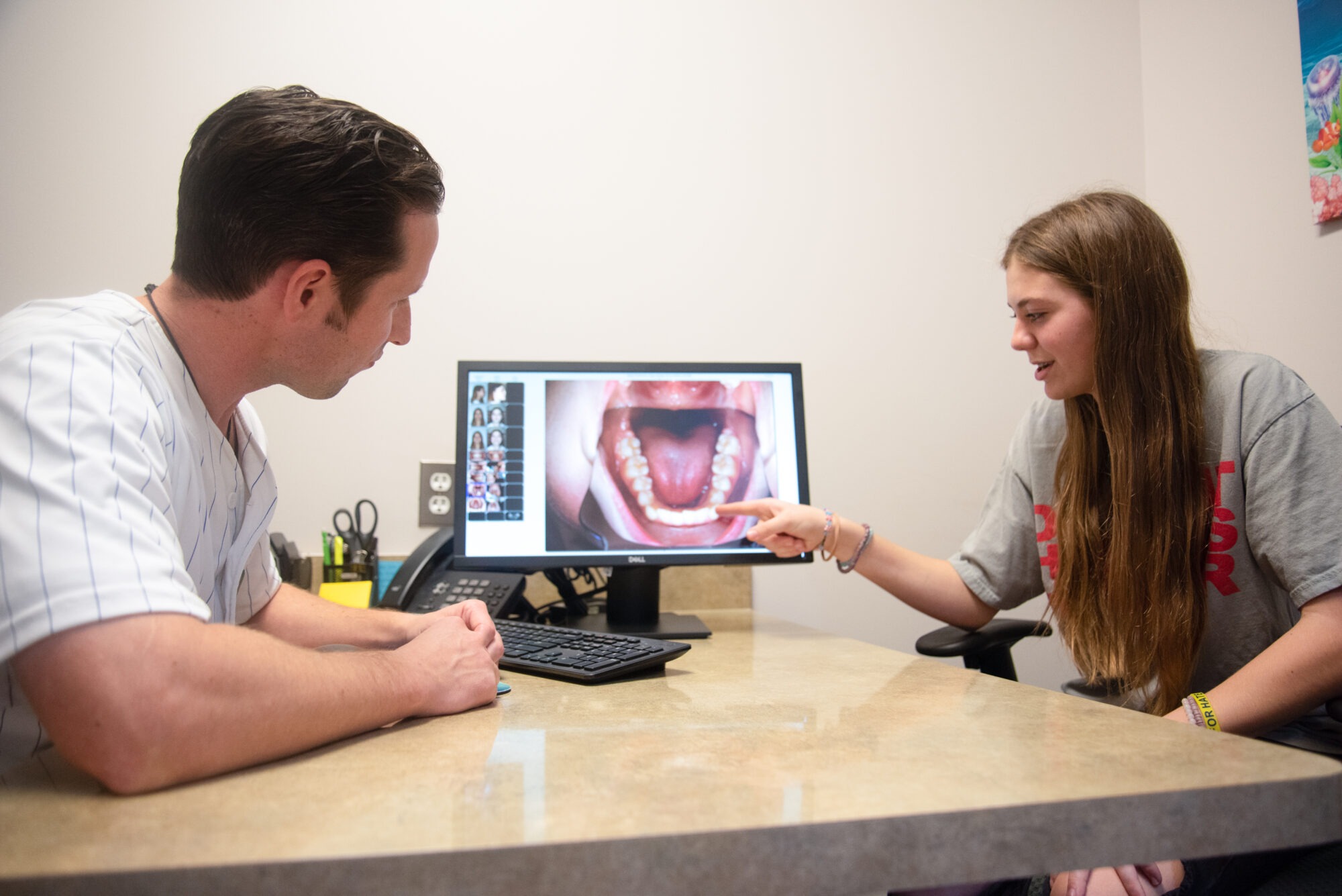Clear Aligners for Teens