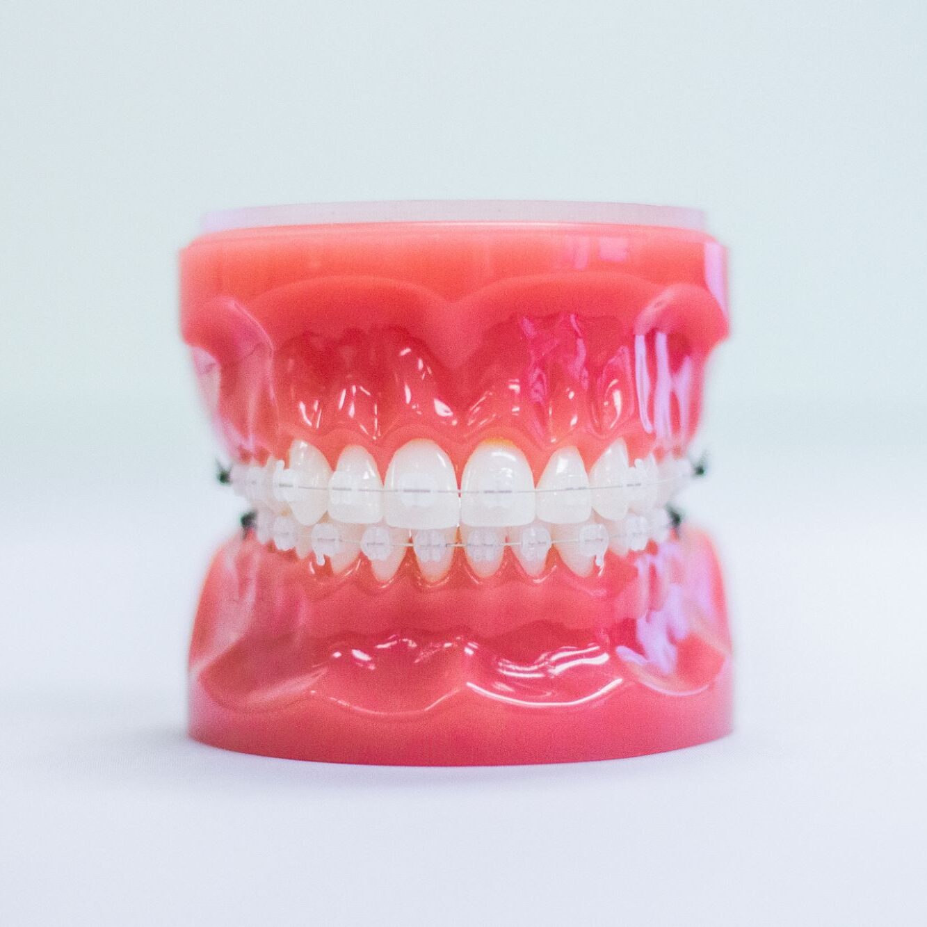 clear braces gross pointe woods